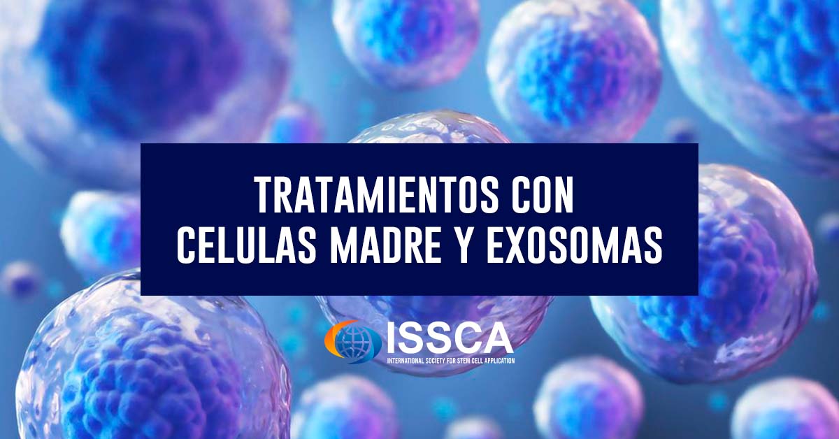 tratamiento celulas madre y exosomas