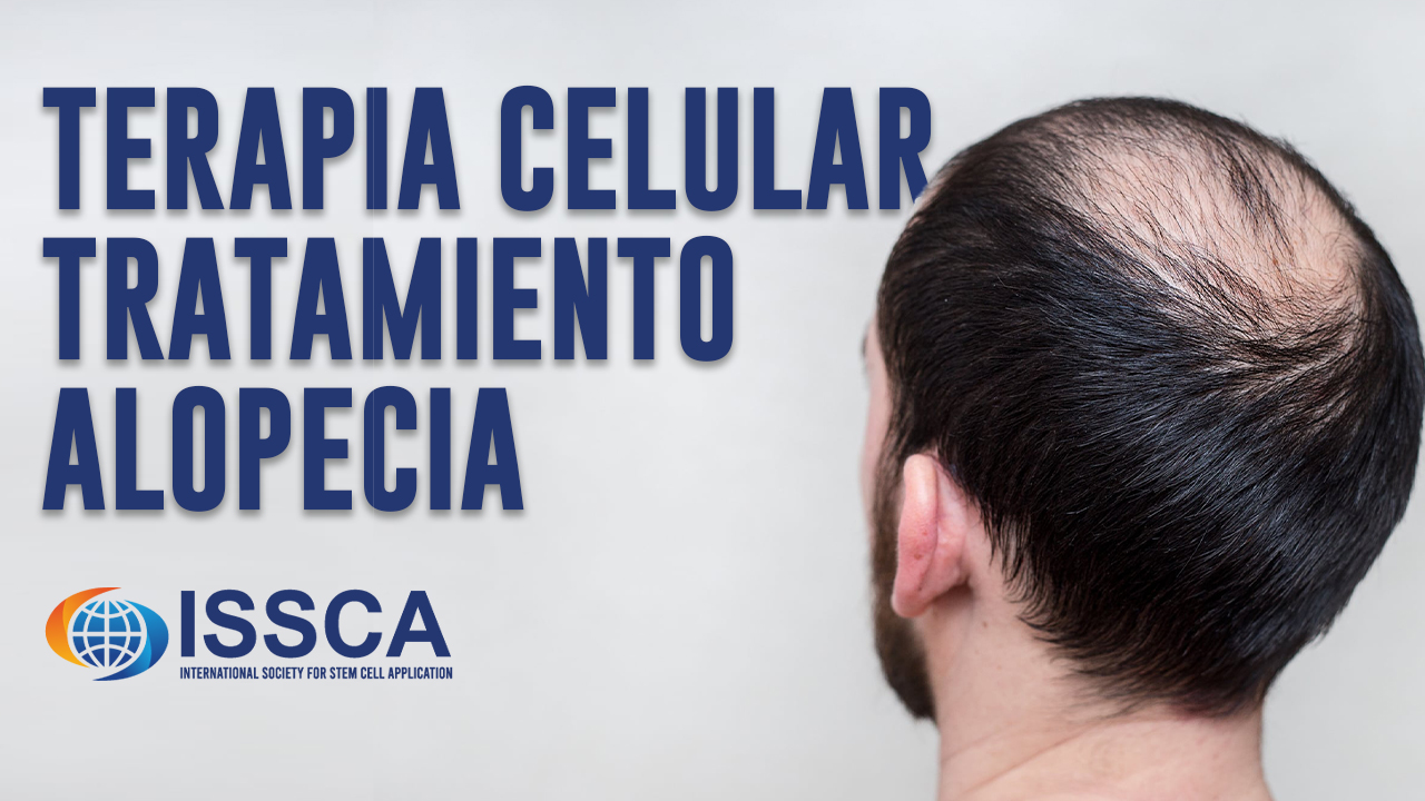 Terapia Celular Alopecia